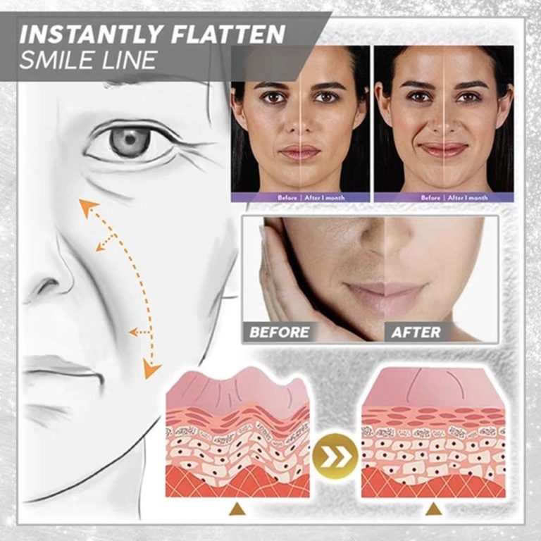 1 + 1 Gratis | SkinClean™ Verwijdert rimpels in slechts 1 week! [Laatste dag korting]