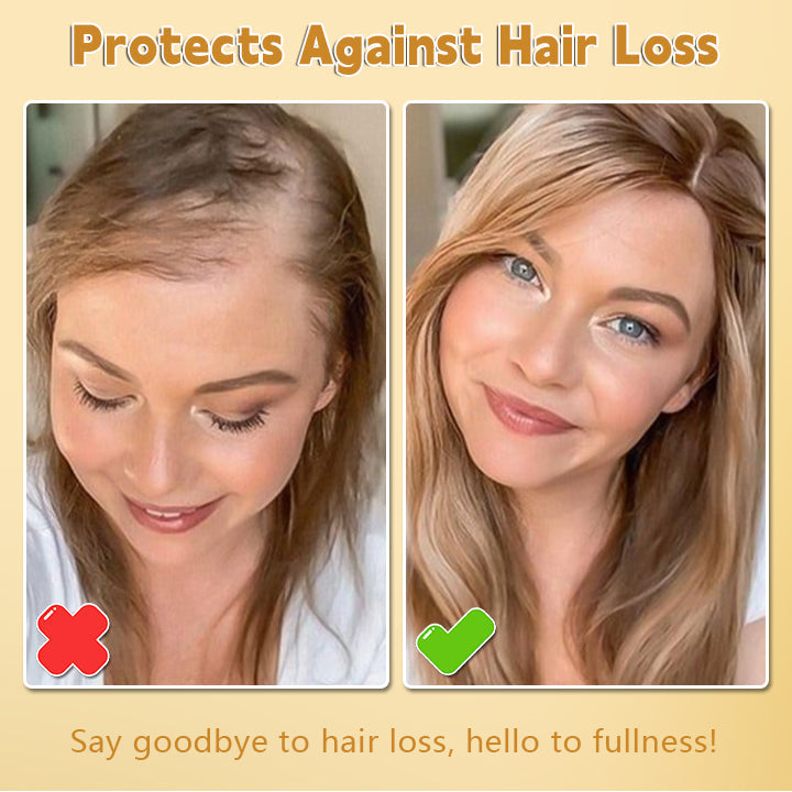 Biotin™ - Biotine haarspray tegen haaruitval en broosheid [1 + 1 Gratis]