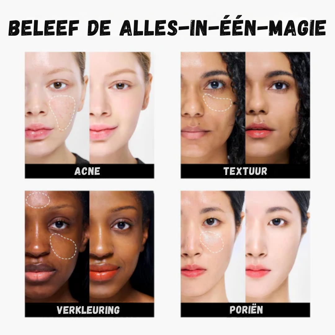 Tfit™ – Driekleurige concealer voor een vlekkeloze finish [50% Korting]