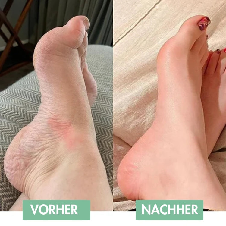 Revivax™ - De innovatieve EMS voetmassage voor onmiddellijke verlichting! [50% Korting]