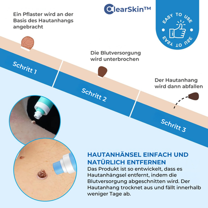 ClearSkin™ Wrattenverwijderaar Pen – Pijnvrije & Snelle Huidbehandeling