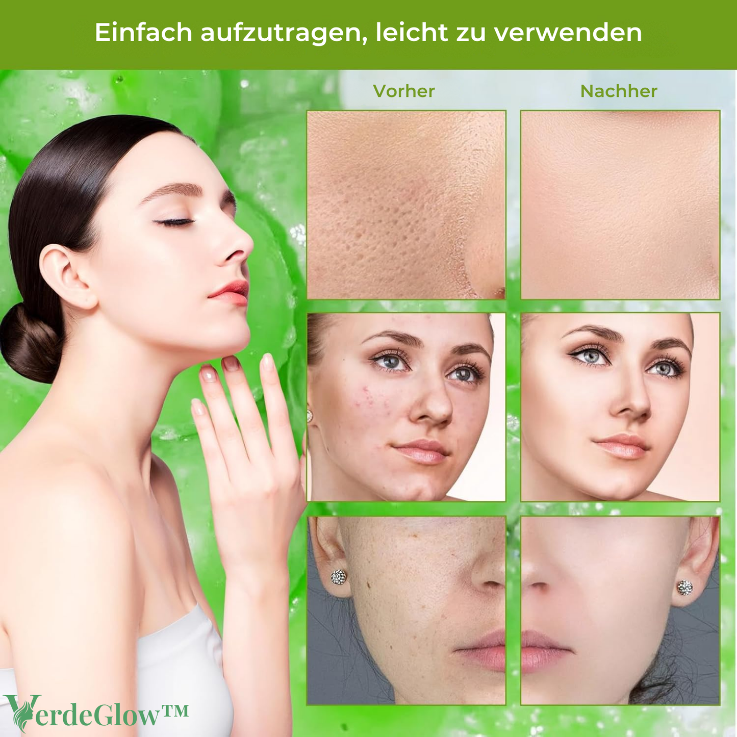 VerdeGlow – Dieptereinigend Kleimasker voor een Heldere, Stralende Huid [1 + 1 Gratis]