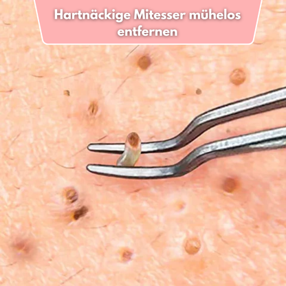 ClearPore™ Mee-eter Verwijderset – Professioneel Pincet voor Acne & Poriën