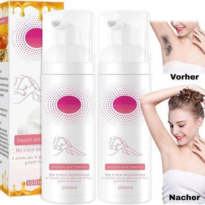 Smoothara – Zachte haarverwijdering zonder scheren [1 + 1 Gratis]