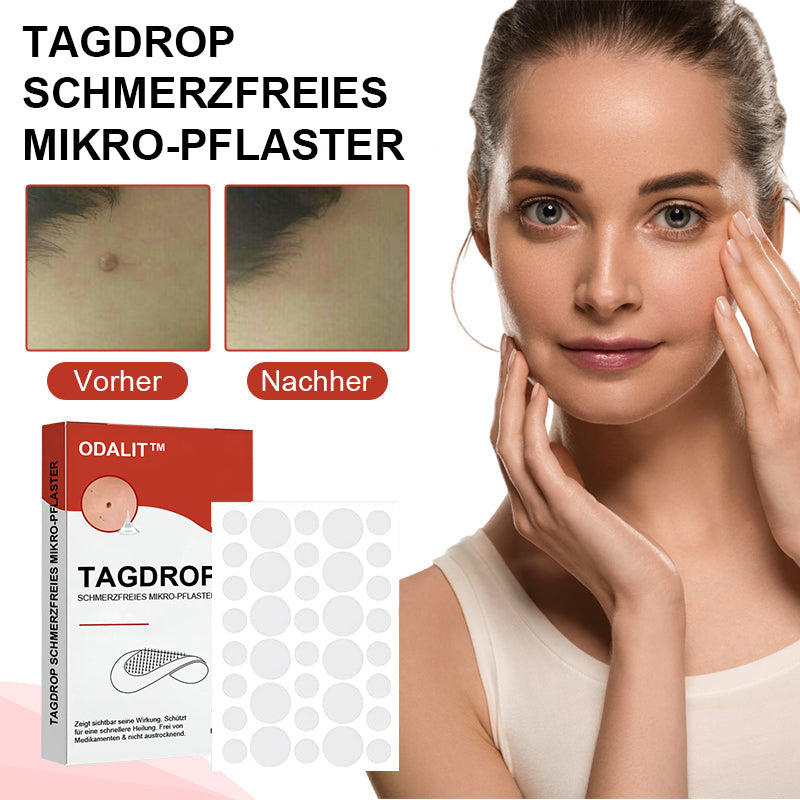Odalit™ - Pijnloze verwijdering van huidincisies [1 + 1 Gratis]