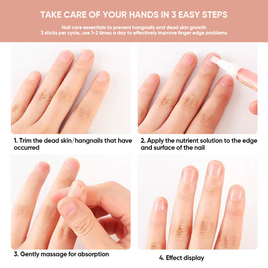 NailShine™ – Hydraterend en versterkend, met vitamine E, C en B7 voor gezonde, glanzende nagels [50% Korting]
