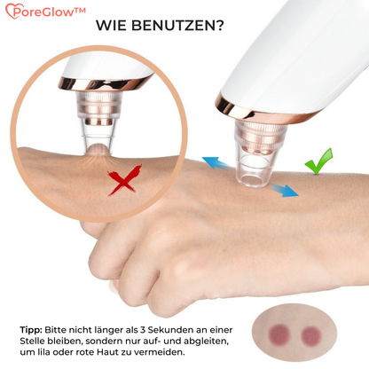PoreGlow™ – Blackhead Verwijderaar Set voor Diepe Porenreiniging