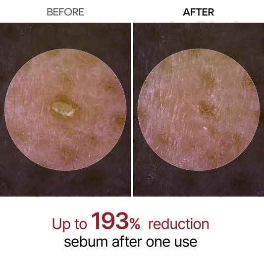 RadianceDuo™ – Stralende, gezonde huid, altijd zichtbaar verzorgd en gerevitaliseerd [50% korting]