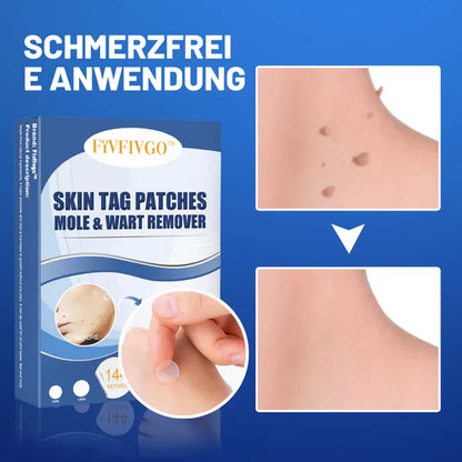 50% korting | TagAway™ - Pleisters voor het verwijderen van huidtags en wratten [laatste dag korting]