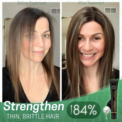 1 + 1 Gratis | NextGrow™ Voorkomt kale plekken [Laatste dag korting]