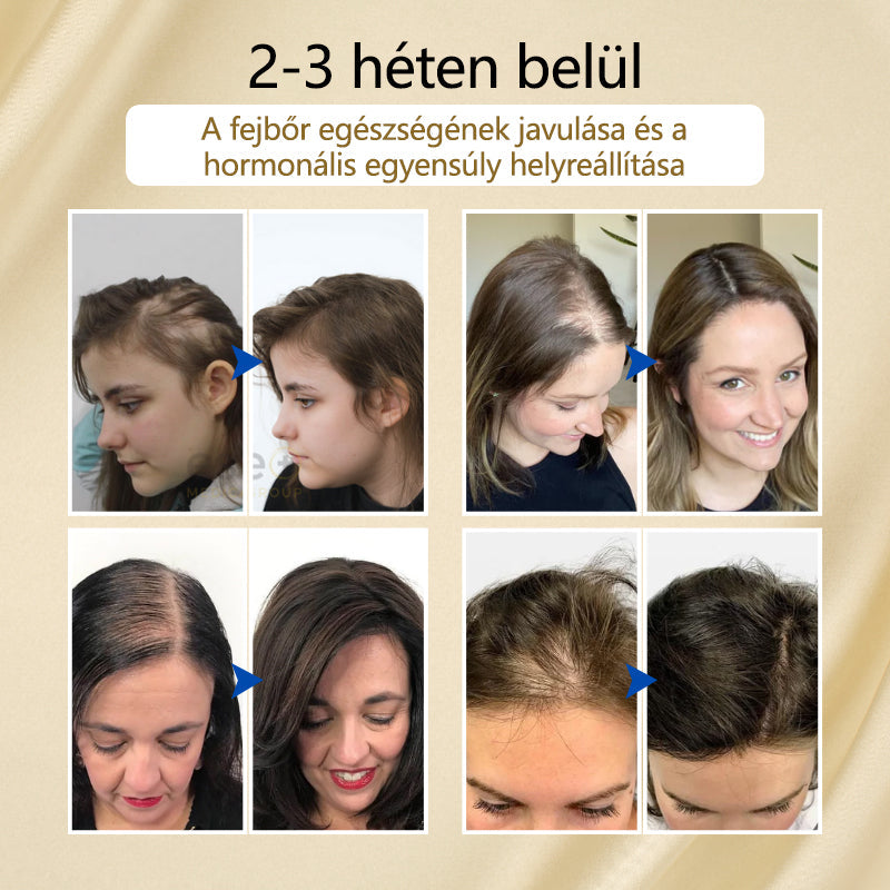 Timilk™ – VitaStrand biotinespray ter bevordering van haargroei voor vol, glanzend haar [1 + 1 Gratis]