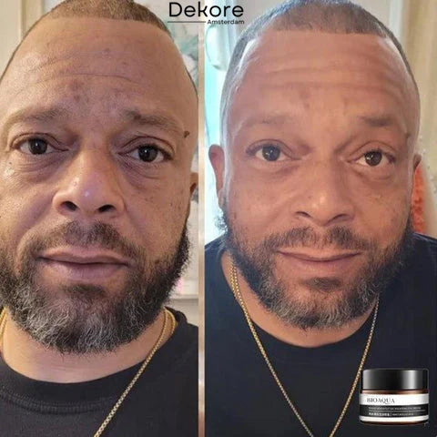 YouthGlow™ – Ontdek vandaag nog de bron van je verjonging [50% Korting]