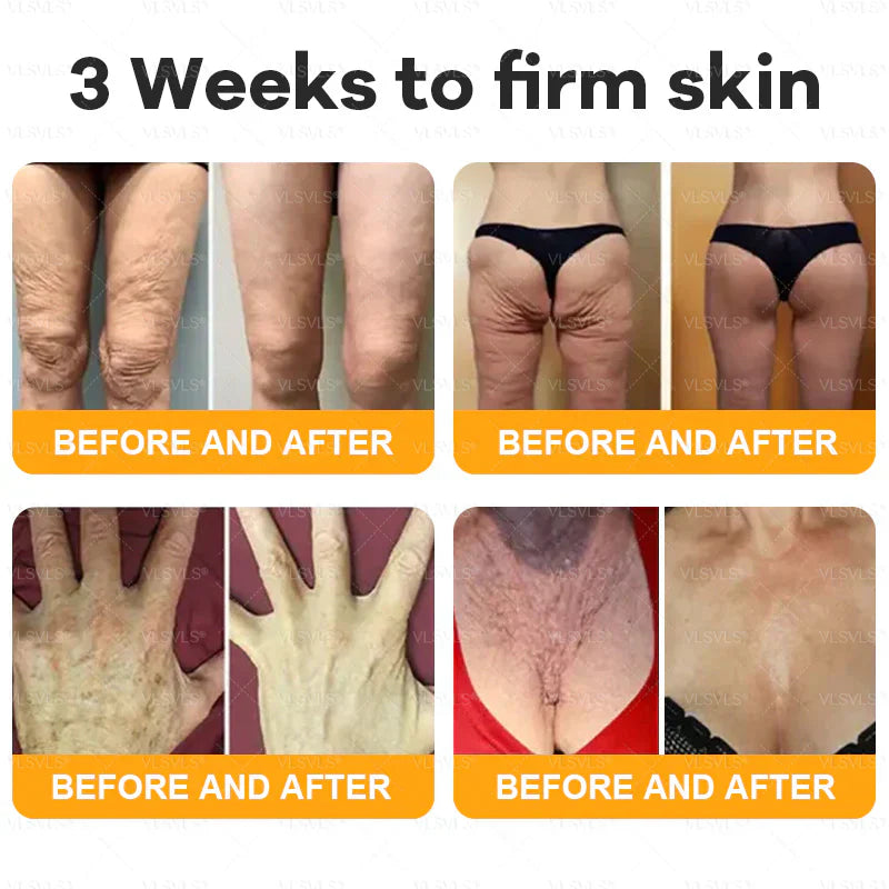 Venlure™ – Verjongende bijengifcrème voor gladdere & stralendere huid [50% Korting]