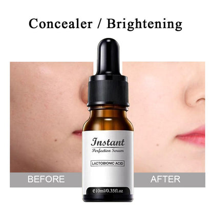 DermaYouth™ Anti-Aging Serum met Argireline – Rimpels Verminderen [1+1 Gratis]