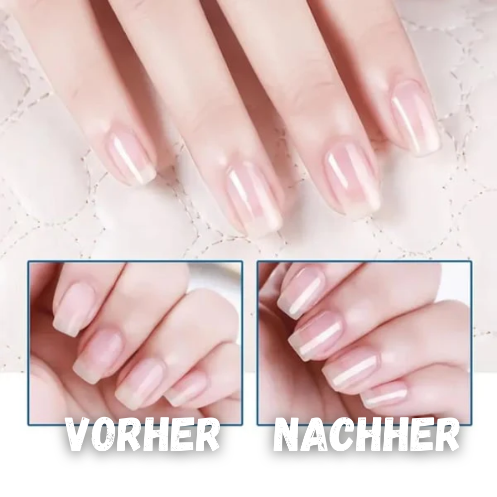 NailRevive – Nagelonderhoudsolie voor natuurlijk glanzende en gezonde nagels [1 + 1 Gratis]