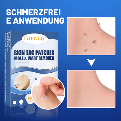TagAway™ – Verwijdert huidflapjes pijnloos, moeiteloos en veilig [50% Korting]
