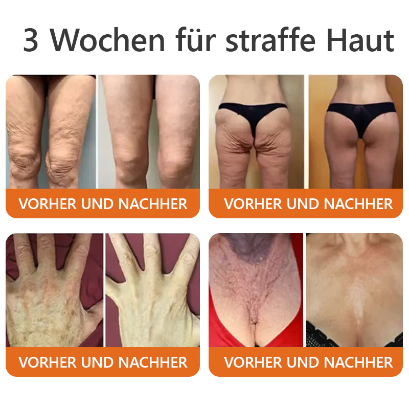 Lenaro™ - Zachte herstellende crème voor het hele gezin [1+1 Gratis]