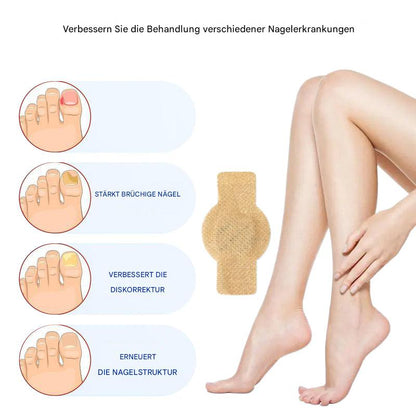 Nailox™ – Voor heldere, gezonde nagels met discrete verzorging de hele dag door [1 + 1 Gratis]