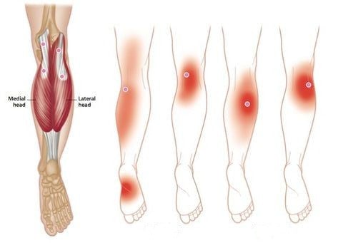 KneeBand™ – Snelle, effectieve verlichting bij kniepijn en spanning [50% Korting]