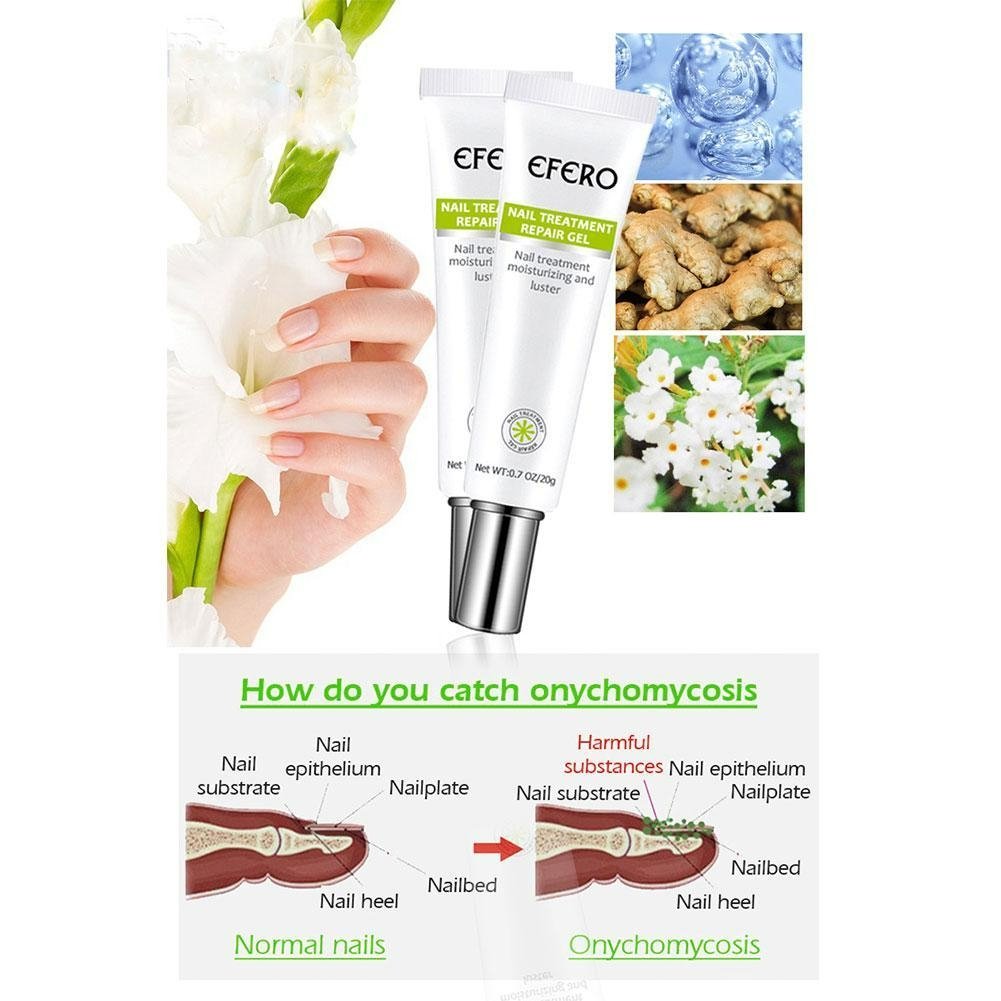 NailReborn™ – Nagelversterker tegen Nagelschimmel & Broze Nagels [1+1 Gratis]