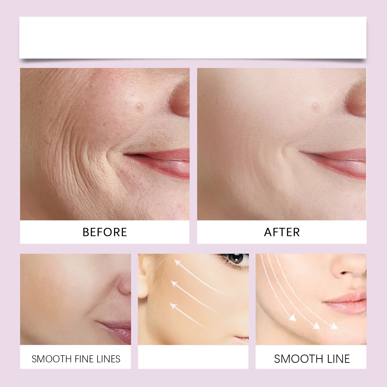 LuxLift™ – Lift je kin en geeft een jeugdige uitstraling in enkele seconden [50% Korting]