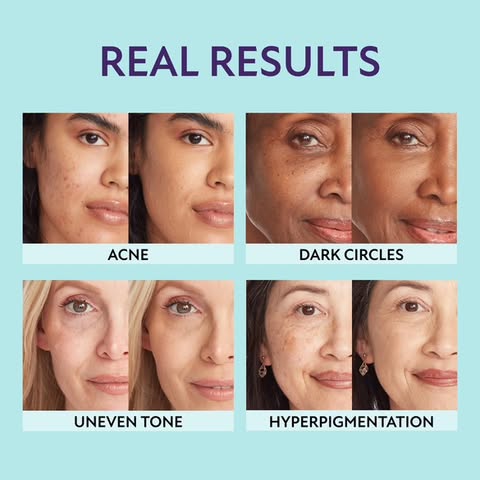 Glowpreme™ – Dekkende Huidperfector Crème voor Littekens & Oneffenheden
