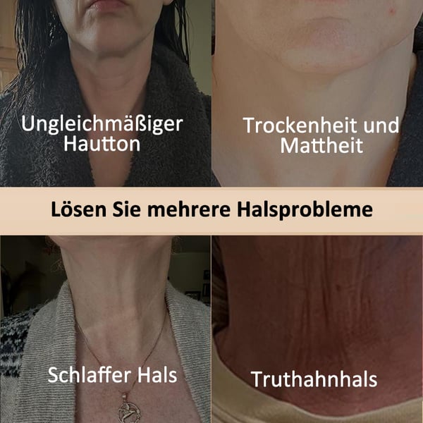 Firmify™ - Verstevigende hals- en lichaamscrème [1 + 1 Gratis]