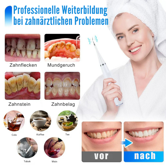 ToothClean – Professionele Tandreiniging voor stralend schone tanden en frisse adem [50% Korting]