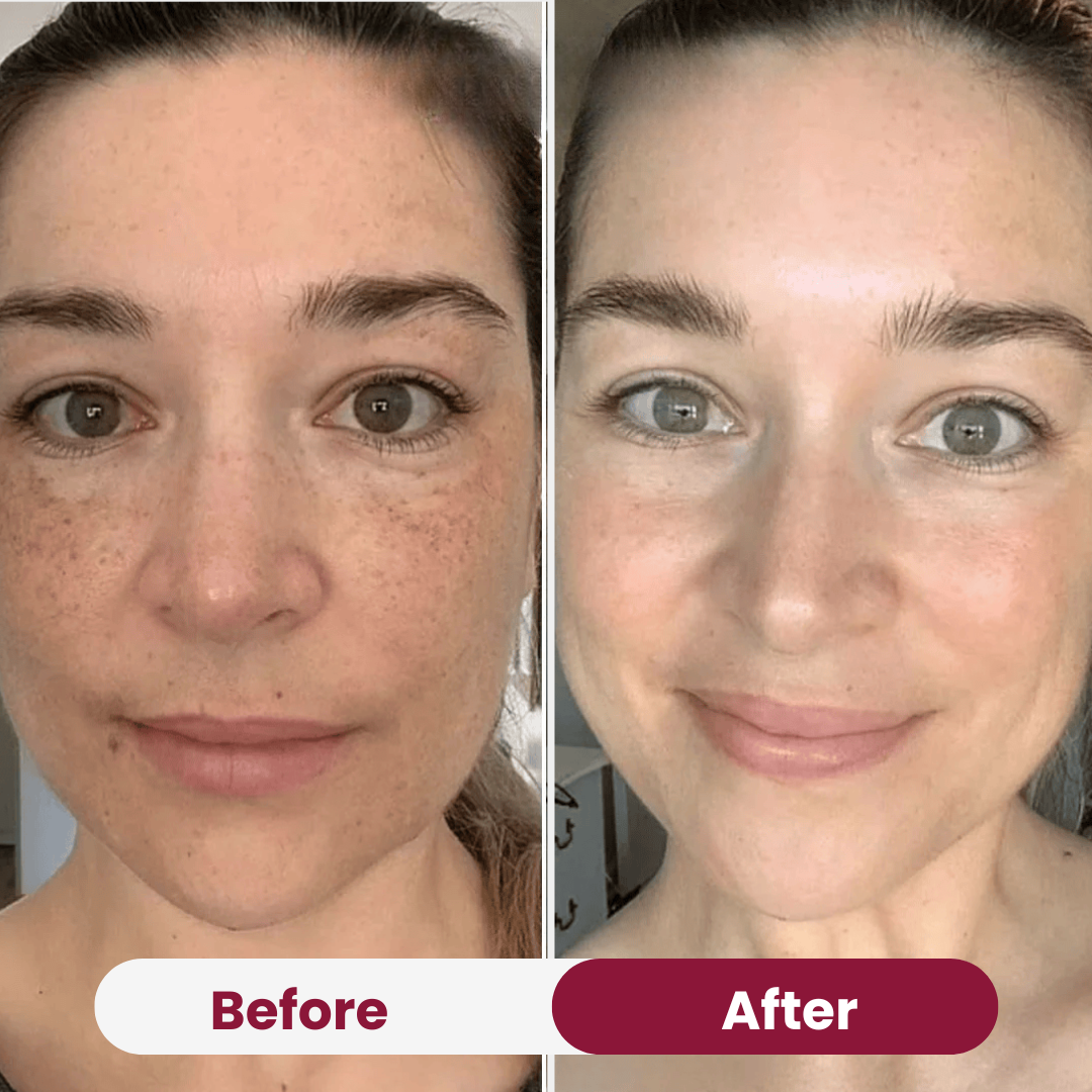 Nifora™ – Intensief Verzorgend Masker voor Jeugdige, Stralende Huid [1 + 1 Gratis]