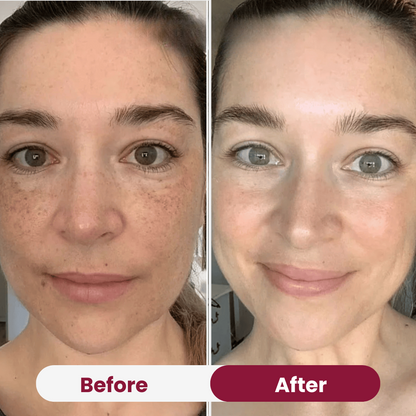 Nifora™ – Intensief Verzorgend Masker voor Jeugdige, Stralende Huid [1 + 1 Gratis]