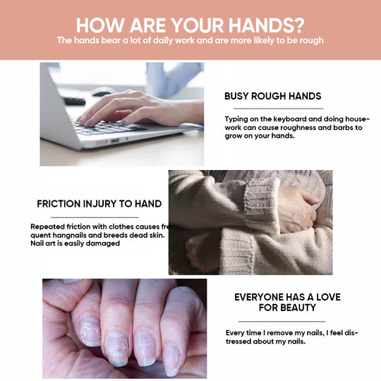 NailGrowth™ – Hydraterende & versterkende formule met vitamine E & biotine, 5 g [50% Korting]