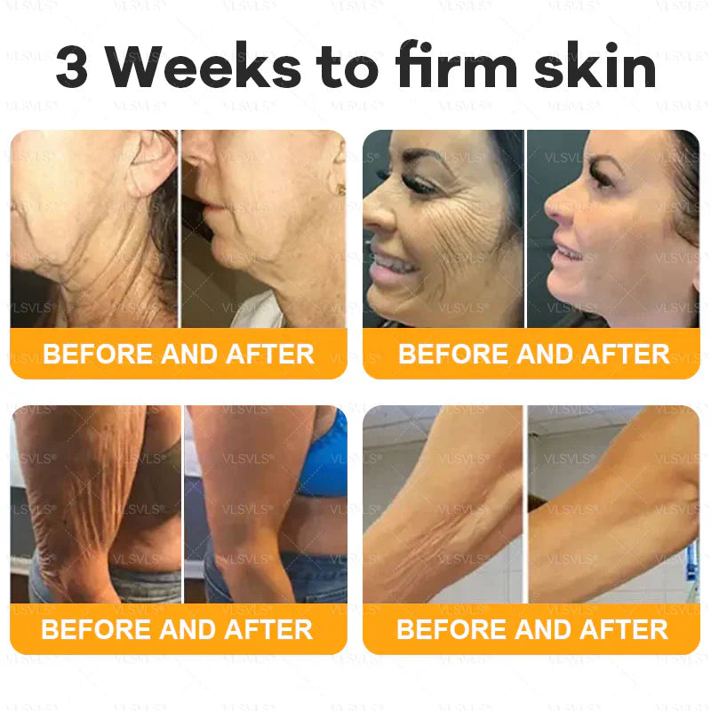 Venlure™ – Verjongende bijengifcrème voor gladdere & stralendere huid [50% Korting]