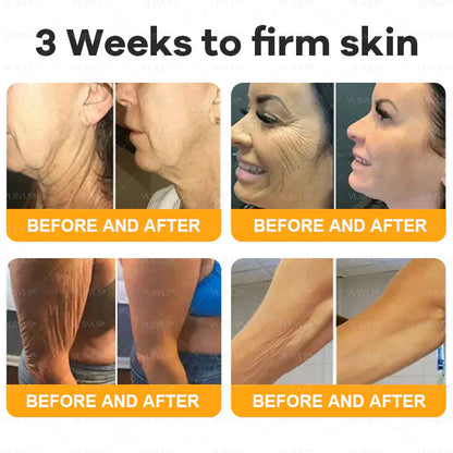 Venlure™ – Verjongende bijengifcrème voor gladdere & stralendere huid [50% Korting]