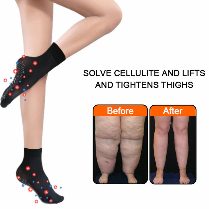 ShapeSocks™ – De ultieme truc om je gewichtsverlies te versnellen [1 + 1 Gratis]