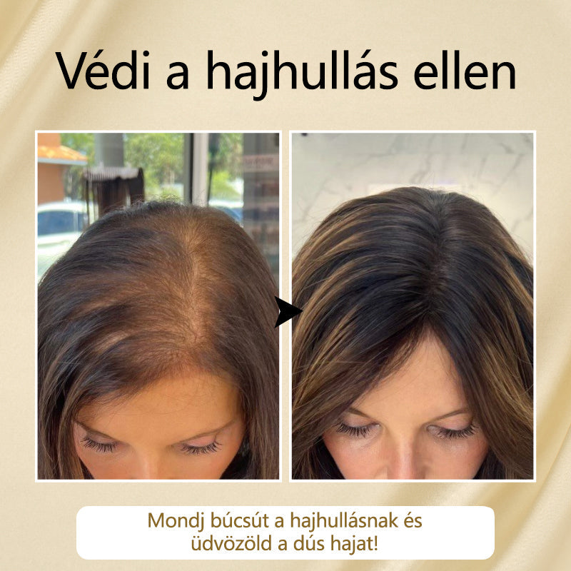 Timilk™ – VitaStrand biotinespray ter bevordering van haargroei voor vol, glanzend haar [1 + 1 Gratis]