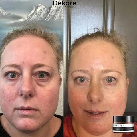 EverYouth™ – Ontdek vandaag nog de bron van je verjonging [50% Korting]