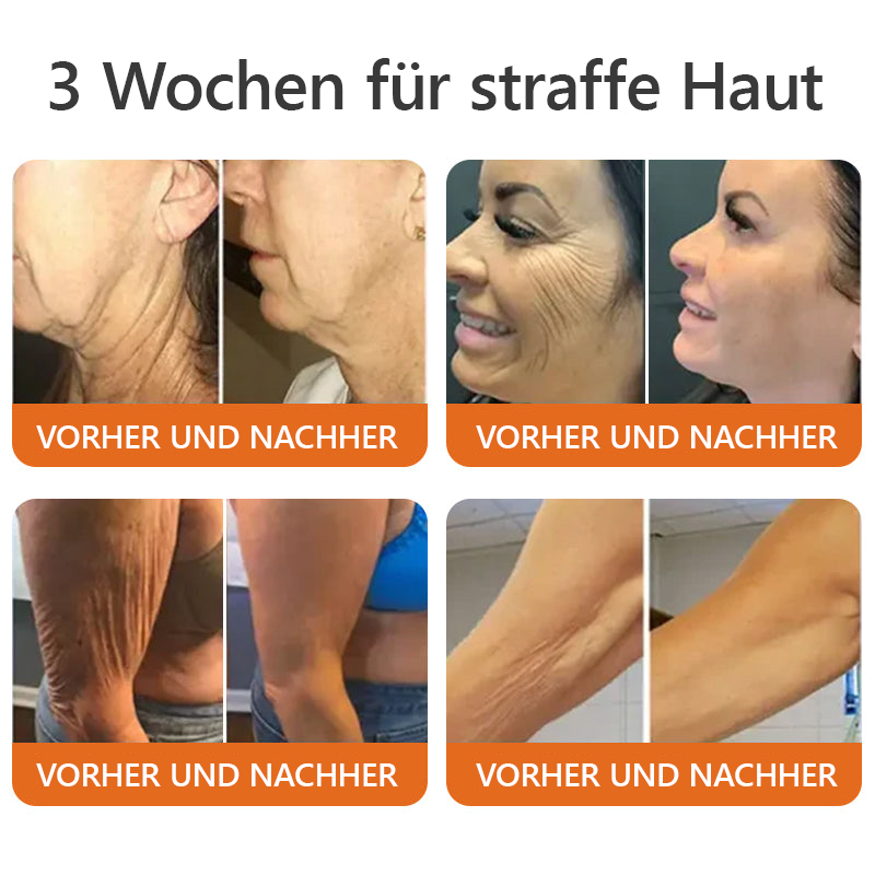 SkinRepair™ - Zachte huidverzorging voor het hele gezin | Zonder cortison en bijwerkingen [1 + 1 Gratis]
