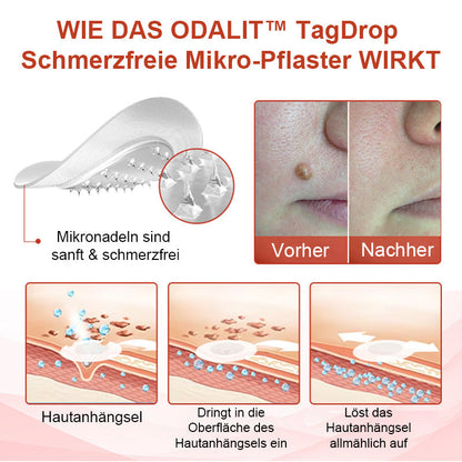 Odalit™ - Pijnloze verwijdering van huidincisies [1 + 1 Gratis]