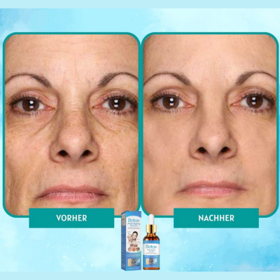 YouthGlow™ – Botox-vrij anti-aging serum voor stralende, jeugdige huid [1 + 1 Gratis]
