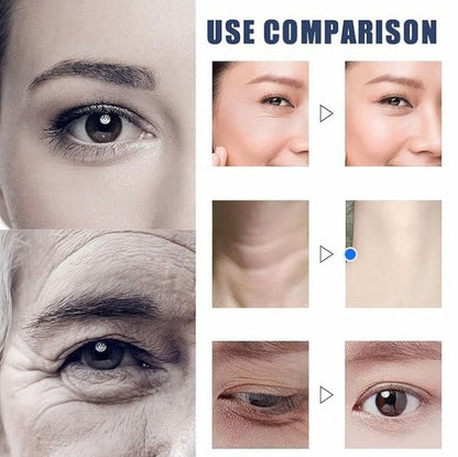 DermalDeep™ – Vult diepe rimpels direct zichtbaar en effectief glad, voor een jeugdige uitstraling [50% korting]