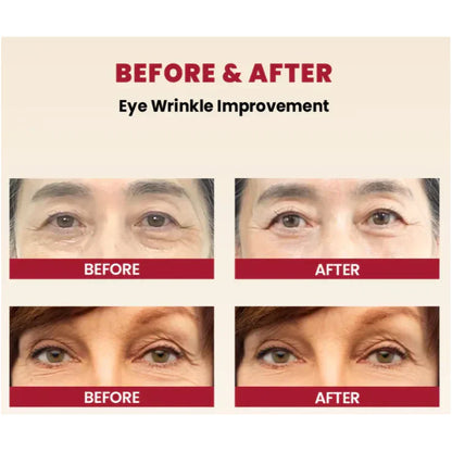 Elixea™ Koreaanse Huidverzorgingsset – Vitamine C, Retinol & Ginseng [1+1 Gratis]