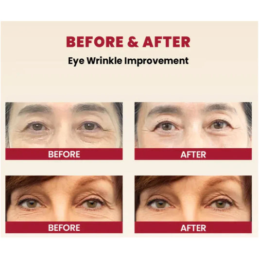 Elixea™ – Koreaanse huidverzorgingsset met vitamine C, retinol & ginseng voor stralende huid [1 + 1 Gratis]