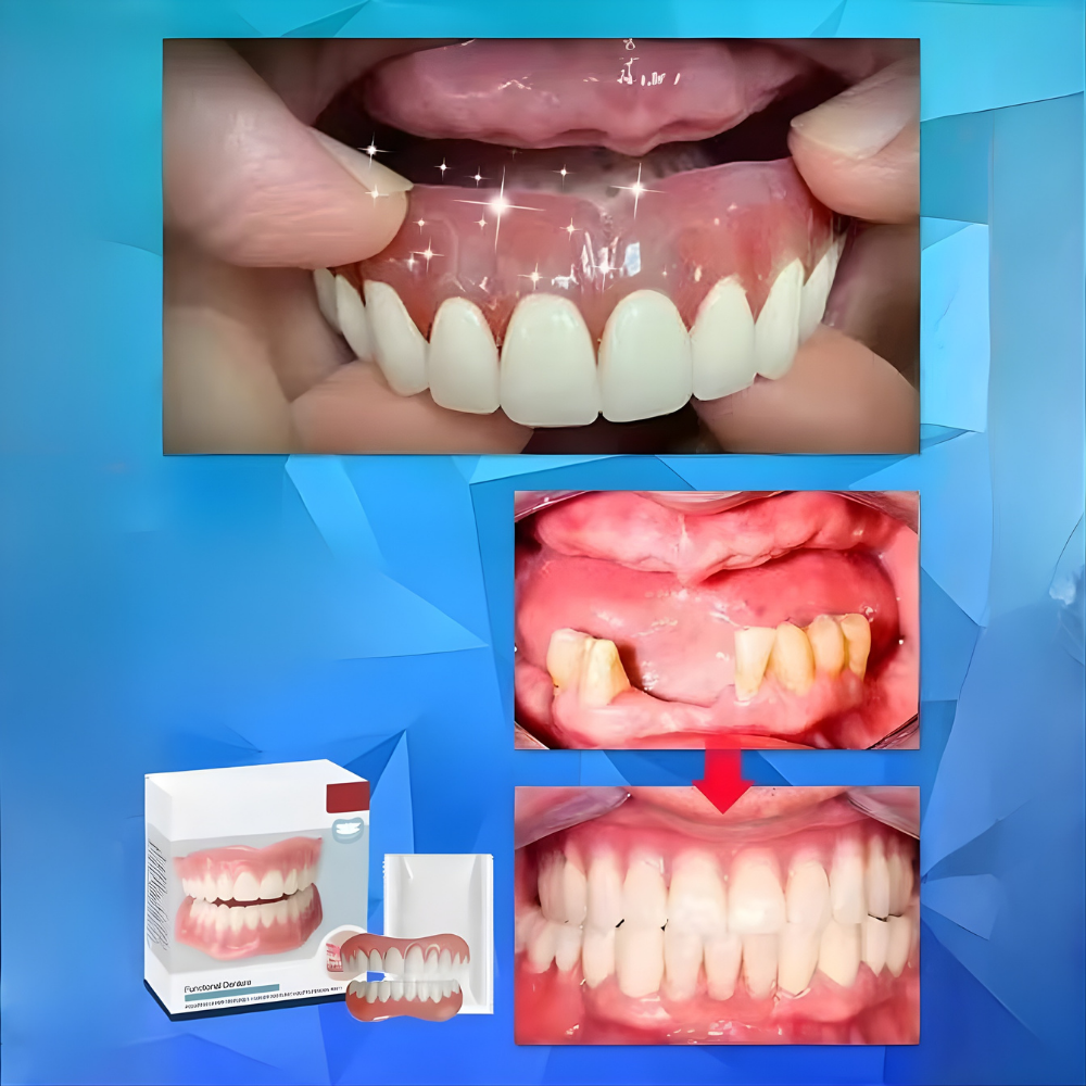 Dentivo™ Snapprothesen Set – Aanpasbare Tandprothese voor Boven- & Onderkaak