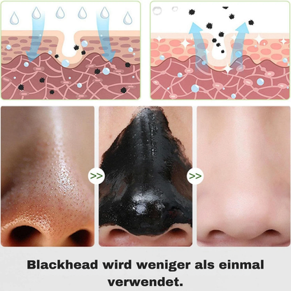 PealClean – Actieve kool Peel-Off Gezichtsmasker voor diep gereinigde poriën [1 + 1 Gratis]