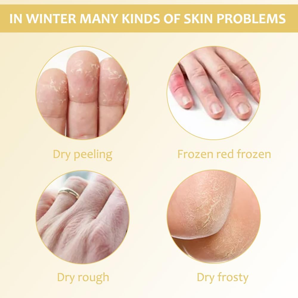 SkinShiner™ – Intensieve verzorging voor droge huid voor herstel en regeneratie [1 + 1 Gratis]