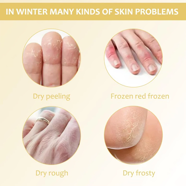 HydraHeel™ – Verzorgende en kalmerende crème voor dagelijkse verlichting [1 + 2 Gratis]