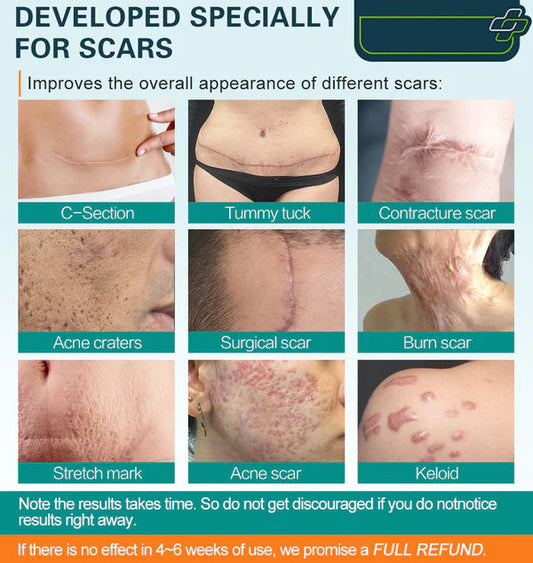 ScarRelief™ – Verzacht geïrriteerde, gevoelige huid snel en effectief [1 + 1 Gratis]