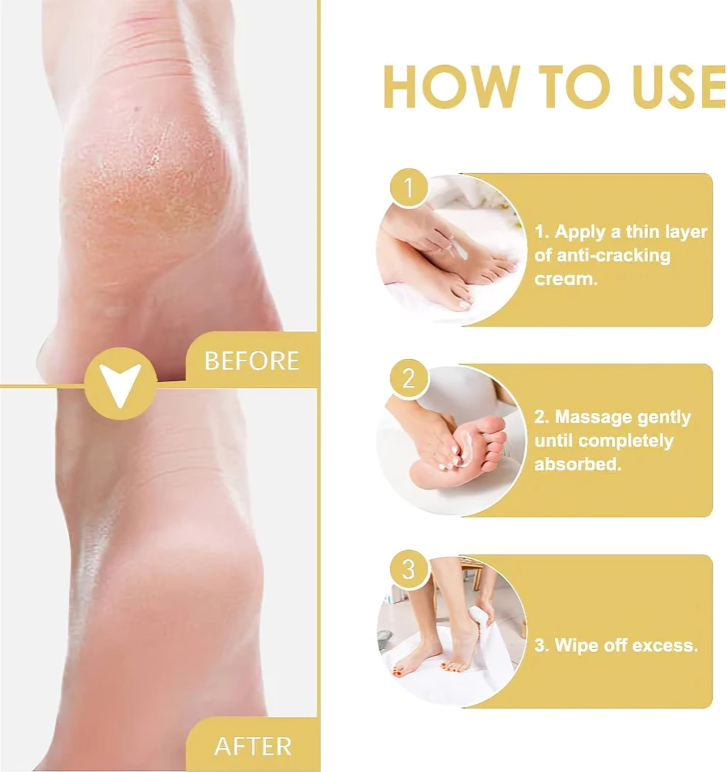 HydraHeel™ – Verzorgende en kalmerende crème voor dagelijkse verlichting [1 + 2 Gratis]