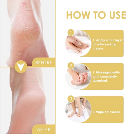 HydraHeel™ – Verzorgende en kalmerende crème voor dagelijkse verlichting [1 + 2 Gratis]