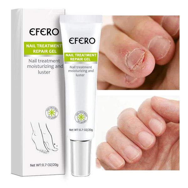 NailSavior™ - Nagelbehandeling reparatie gel [1 + 1 Gratis]